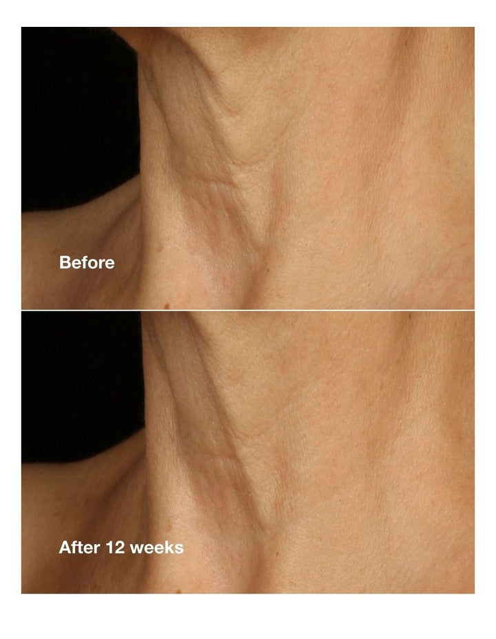 Smart Clinical Repair Lifting Face + Neck Cream