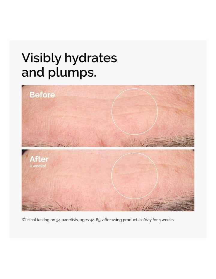 Hyaluronic Acid 2% + B5 Hydrating Serum with Ceramides