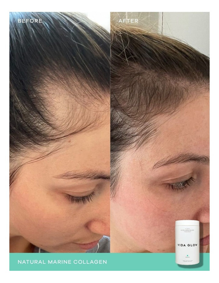 Natural Marine Collagen Caddy- 270g