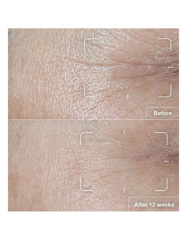 Smart Clinical Repair SPF 15 Wrinkle Correcting Cream 50ml