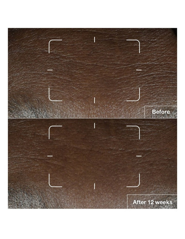 Smart Clinical Repair SPF 15 Wrinkle Correcting Cream 50ml