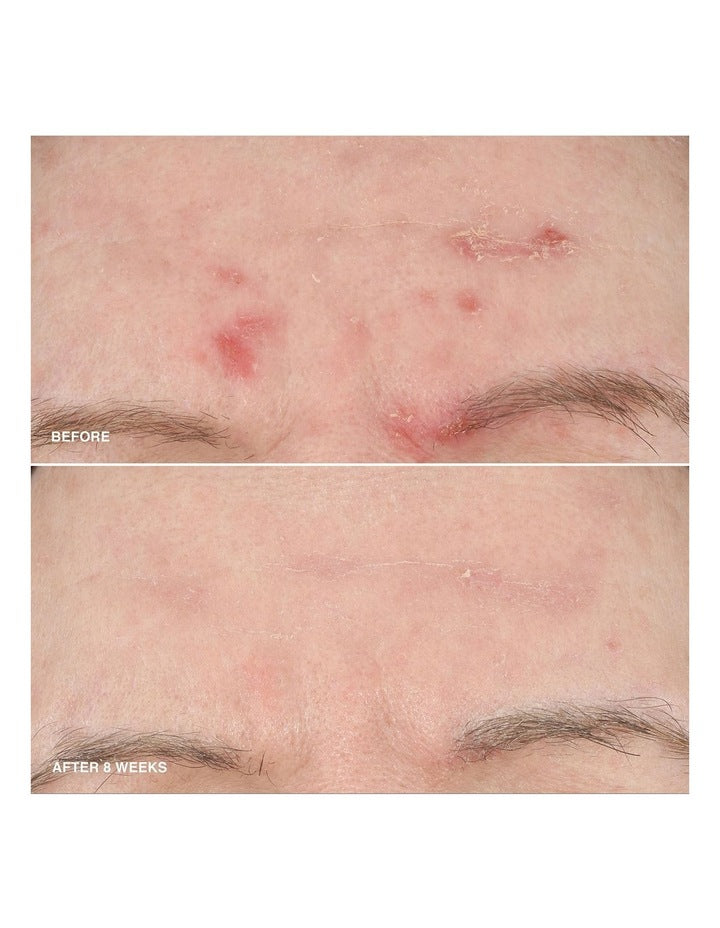 Vitamin Enriched Soothing Serum 30ml