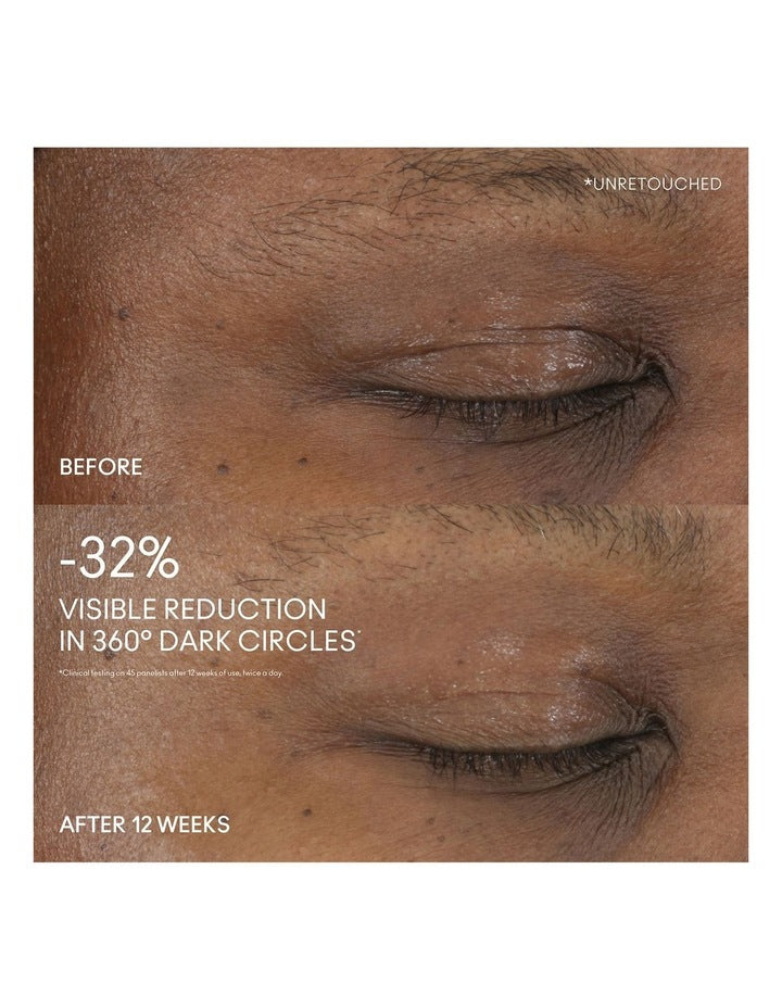 Hyper Real Serumizer Eye 15ml