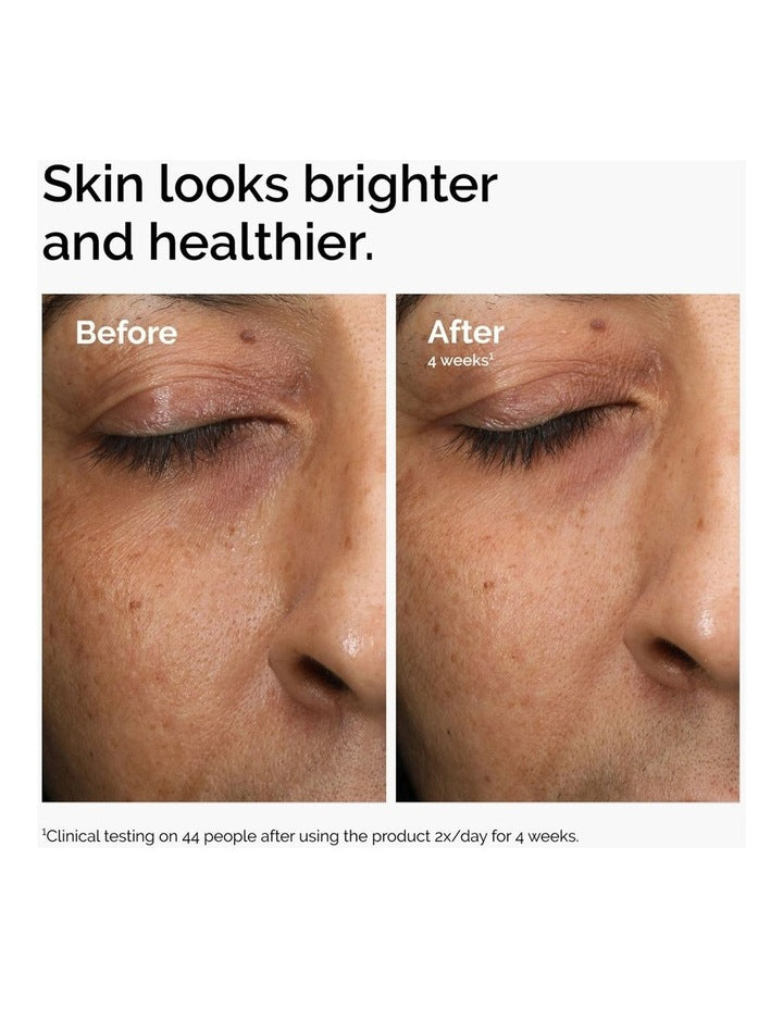 Multi-Antioxidant Radiance Serum with Vitamin C for Brightening and Antioxidant Support 30ml