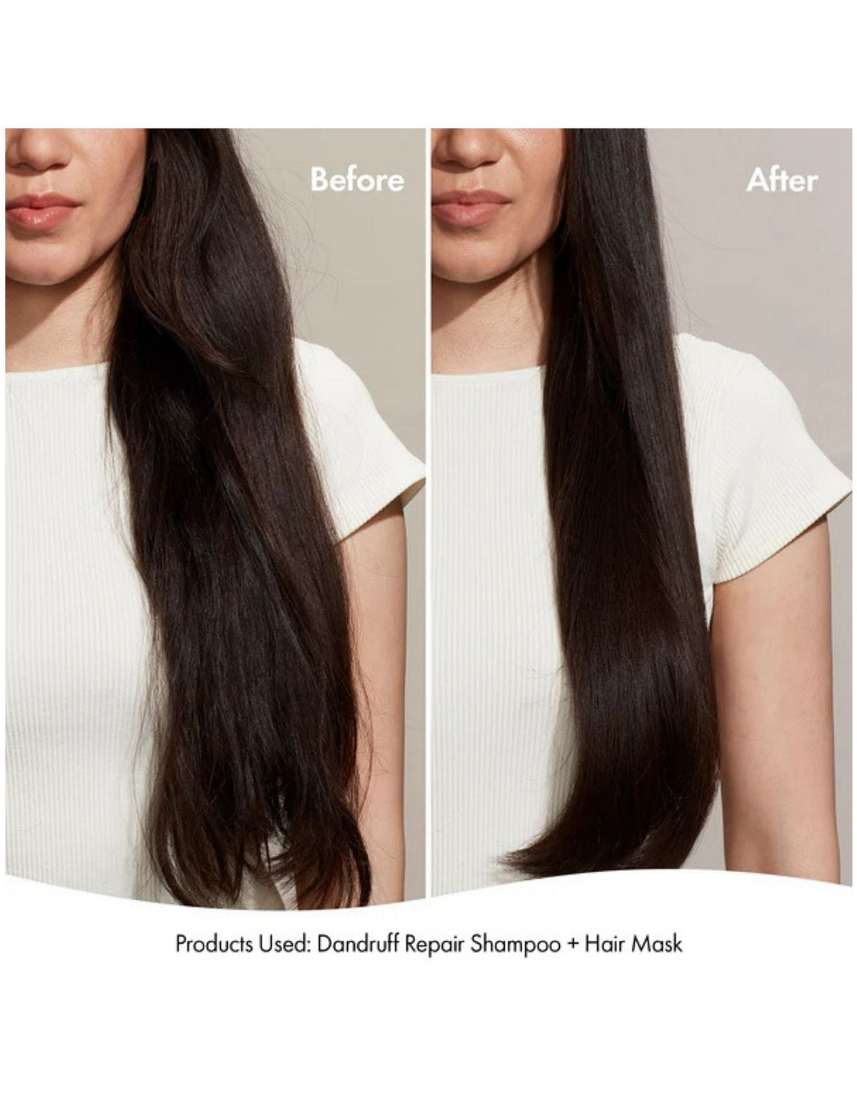 DANDRUFF REPAIR SHAMPOO 300ML