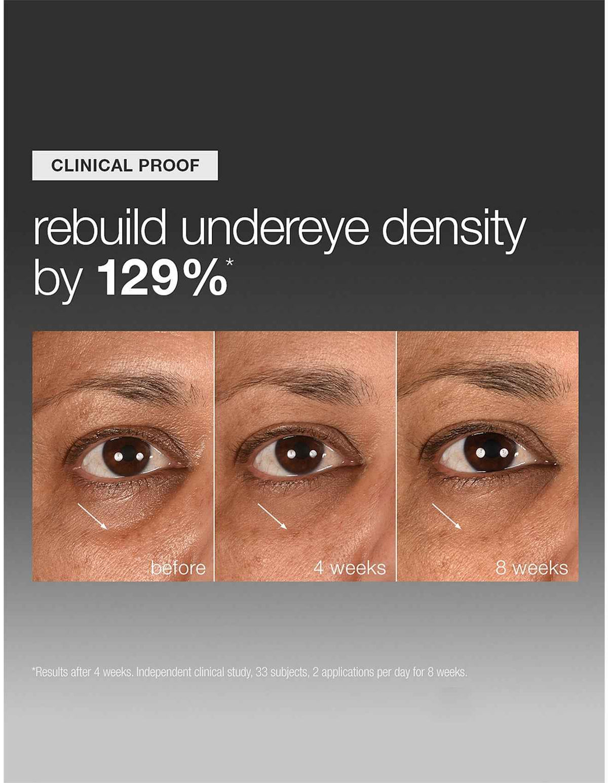 Smart Eye Density Serum 15ml