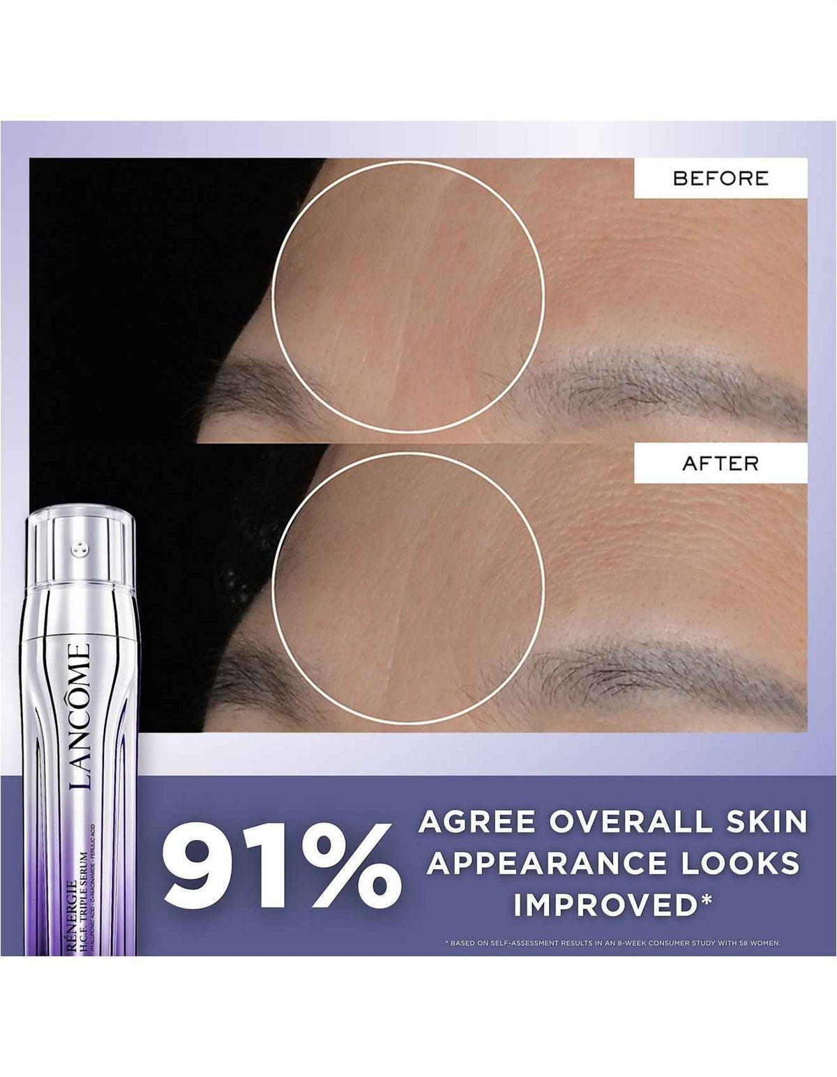 Renergie Triple Serum 20ml Set 2026