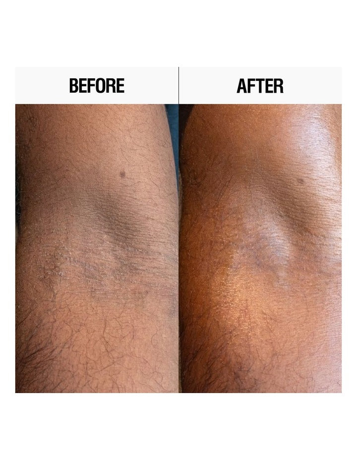 Resurfacing Targeted Body Lotion 300ml