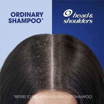 Head & Shoulders 2-in-1 Shampoo & Conditioner Men Sport Fresh 750mL