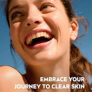 Nivea Derma Skin Clear Scrub 150mL
