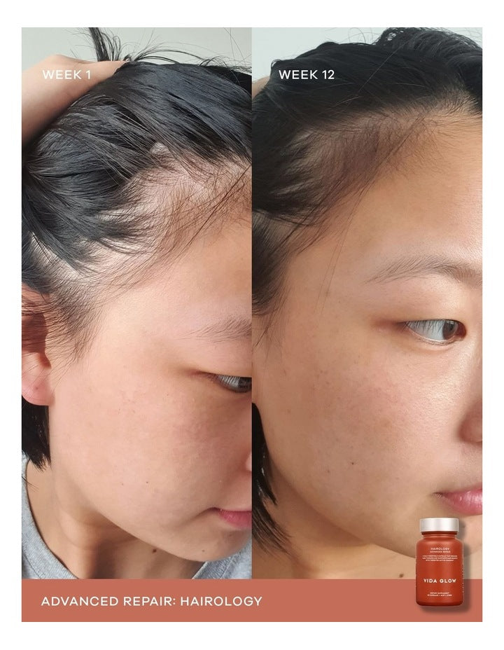 Hairology Supplement