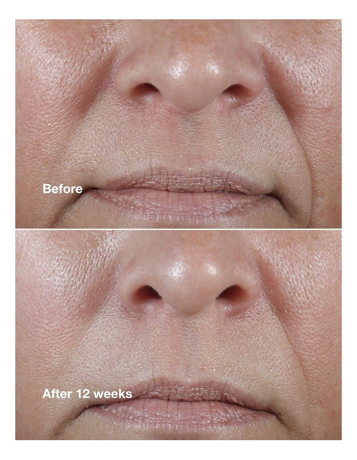 Smart Clinical Repair Wrinkle Correcting Rich Cream