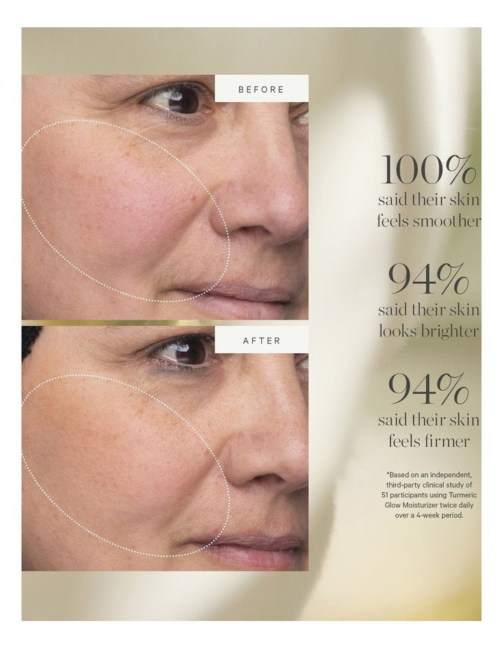 Turmeric Glow Moisturizer 15ml
