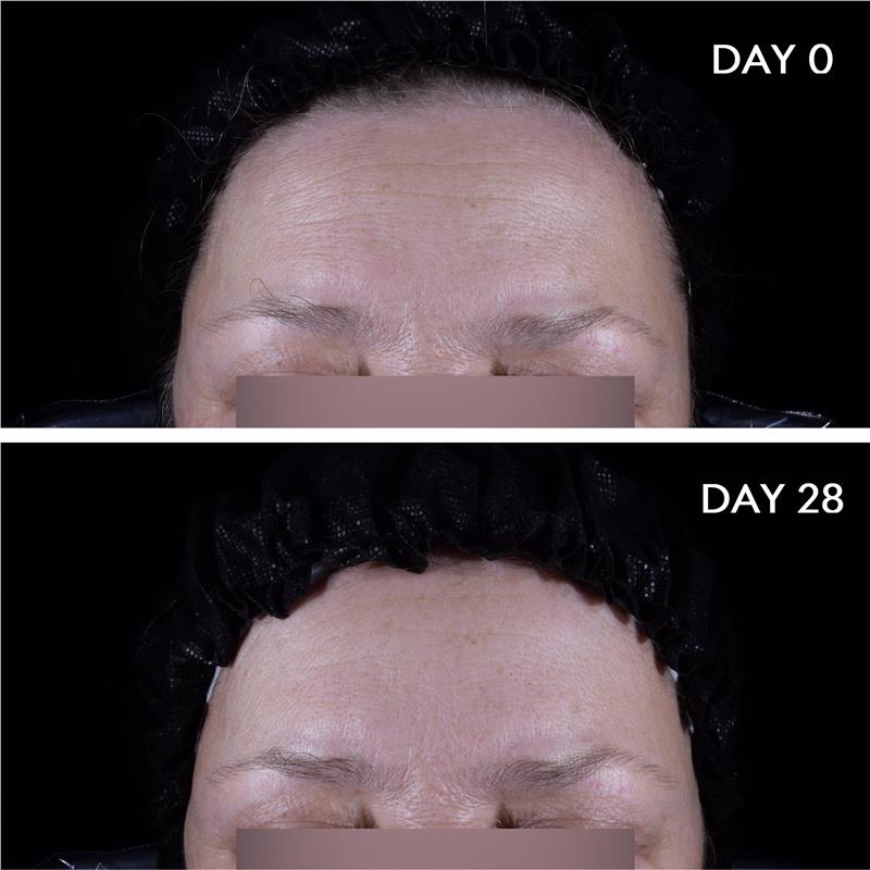 Bioderma Hydrabio Hyalu + Hydrating Plumping Serum with Hyaluronic Acid and Niacinamide 30ml