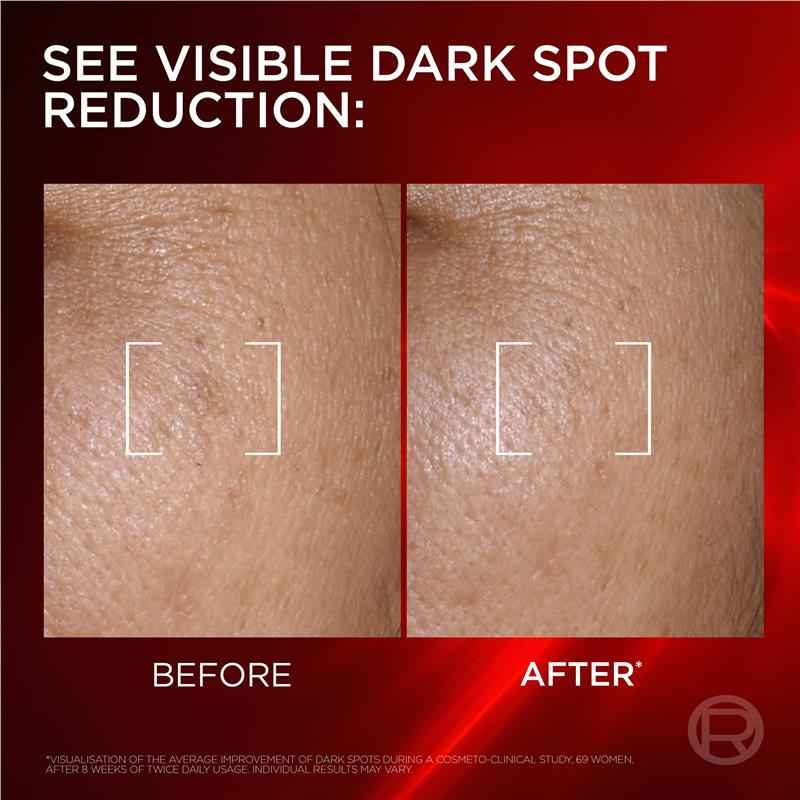 L'Oreal Paris Revitalift Laser Dark Spot Creamy-Serum 50ml
