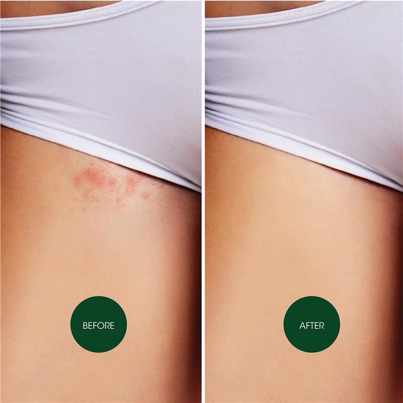 Nad's Ingrow Solution 125mL