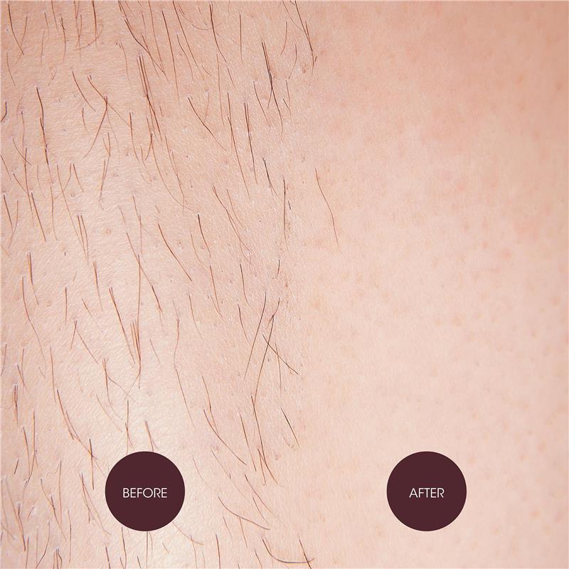 Nad's Sensitive Hair Removal Cream 150ml