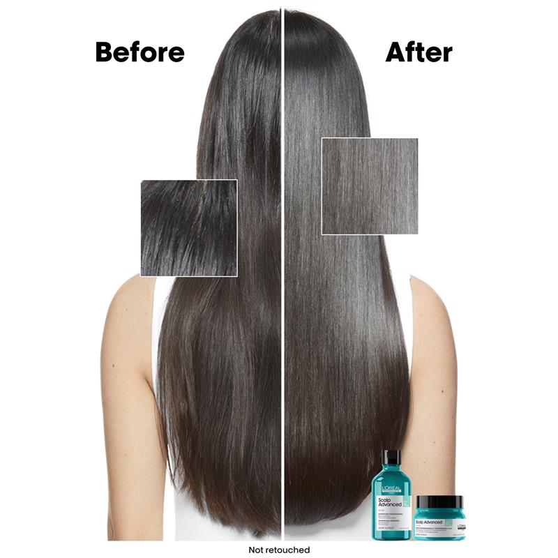 L'Oreal Professionnel Serie Expert Scalp Advanced Anti Oil Mask 250ml