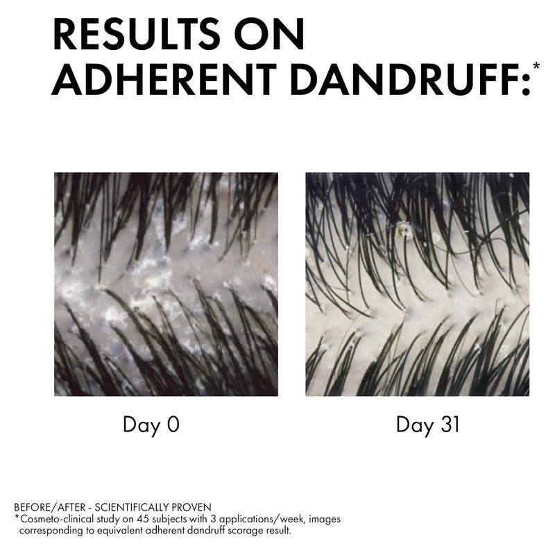 Dercos Anti-Dandruff DS Shampoo for Normal to Oily Hair 200ml