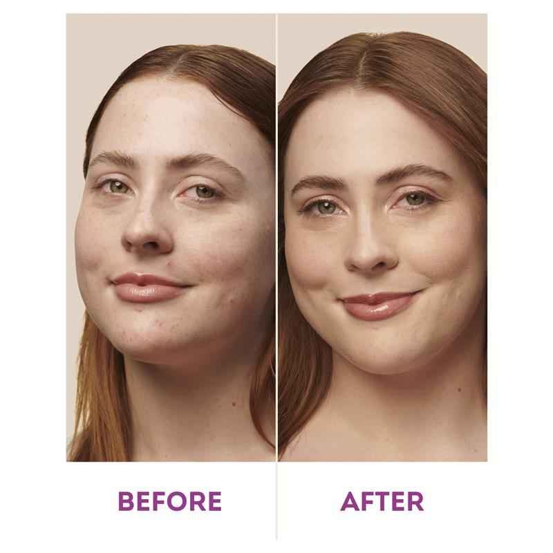 Nude By Nature Natural Mineral Cover Blemish Control Medium 10g
