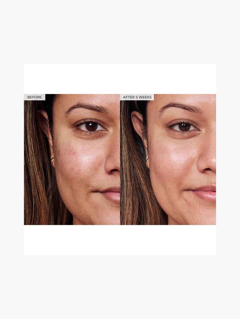 Avocado Ceramide Recovery Serum