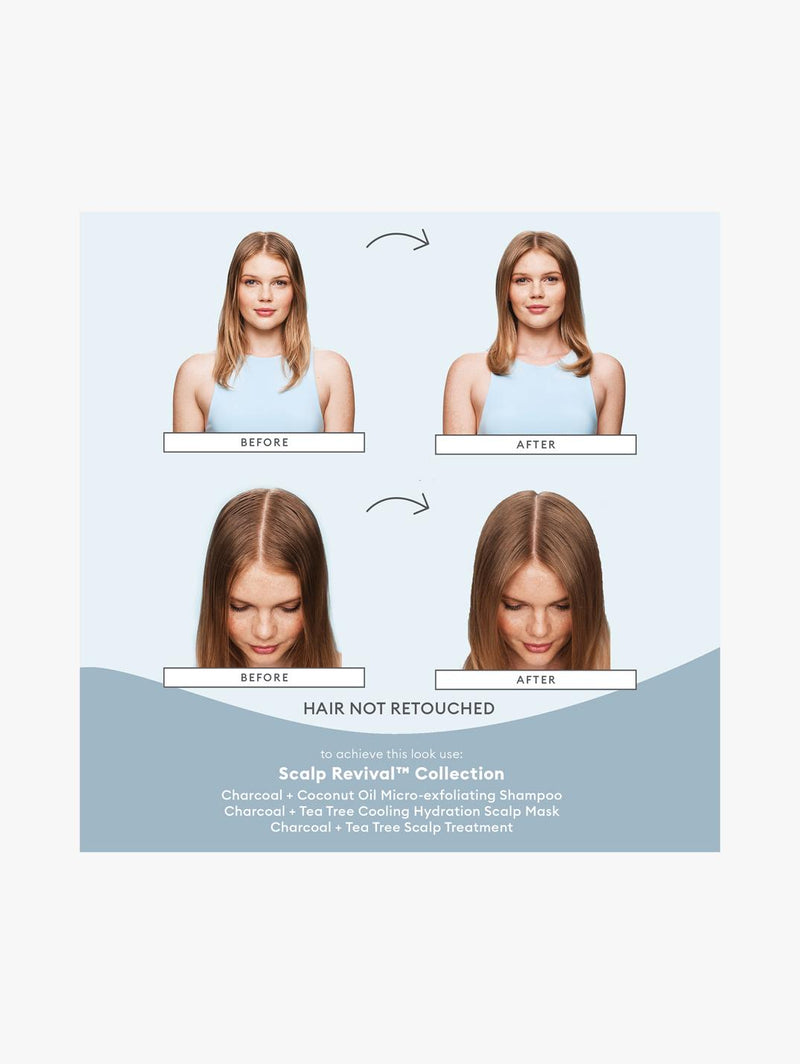 Scalp Revival™ Charcoal + Tea Tree Cooling Hydration Mask for Dry, Itchy Scalp