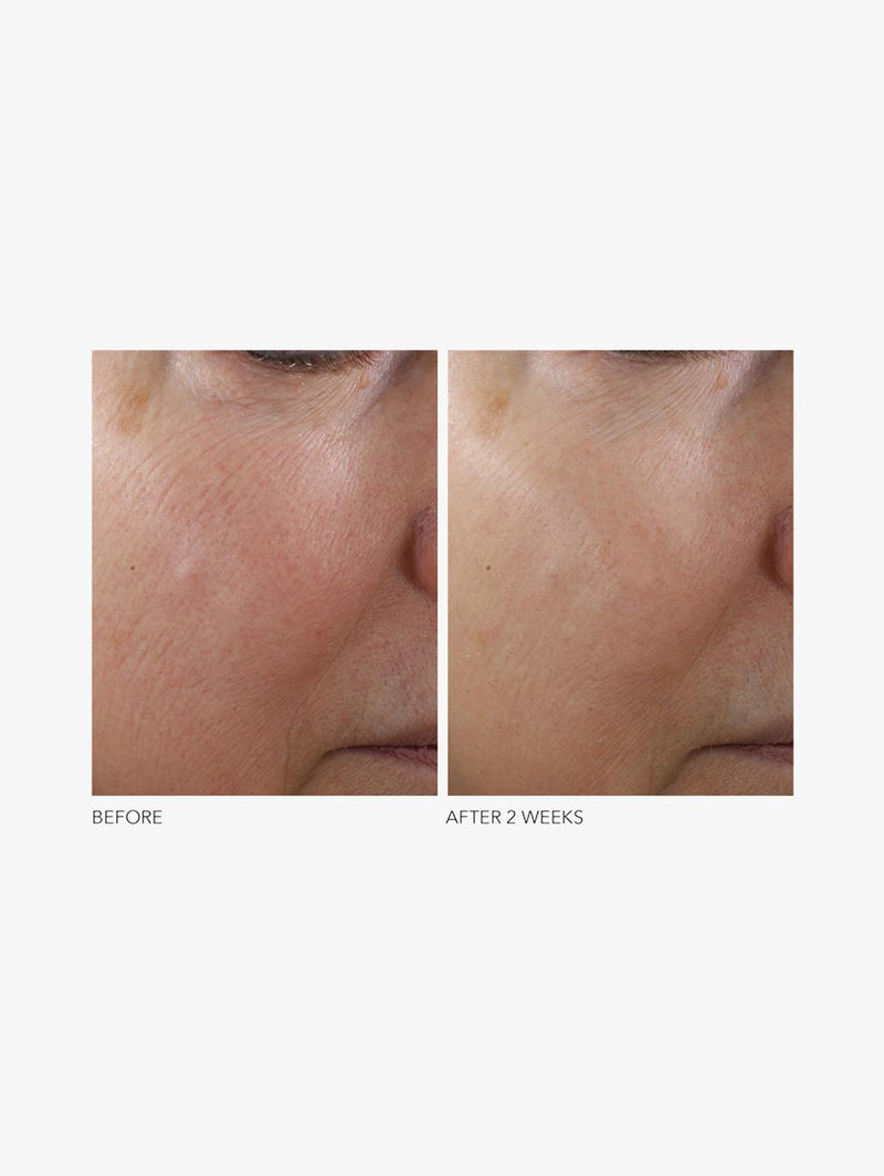 Advanced Retinol + Ferulic Texture Renewal Serum