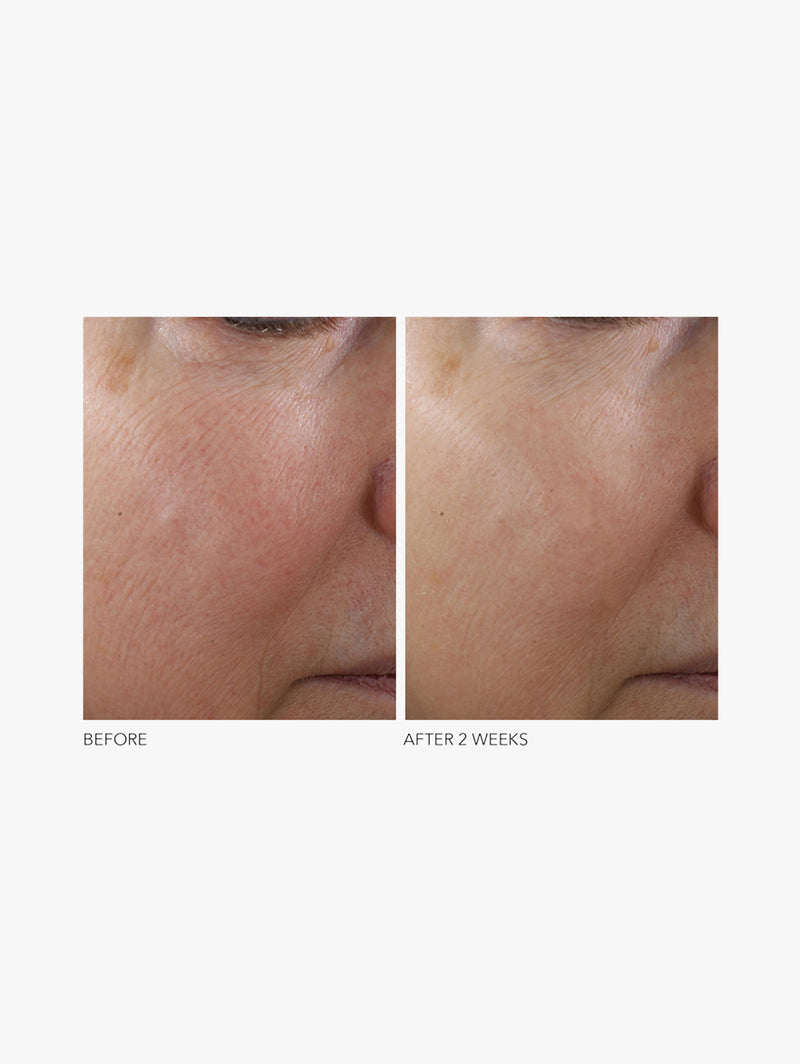 Advanced Retinol + Ferulic Texture Renewal Serum