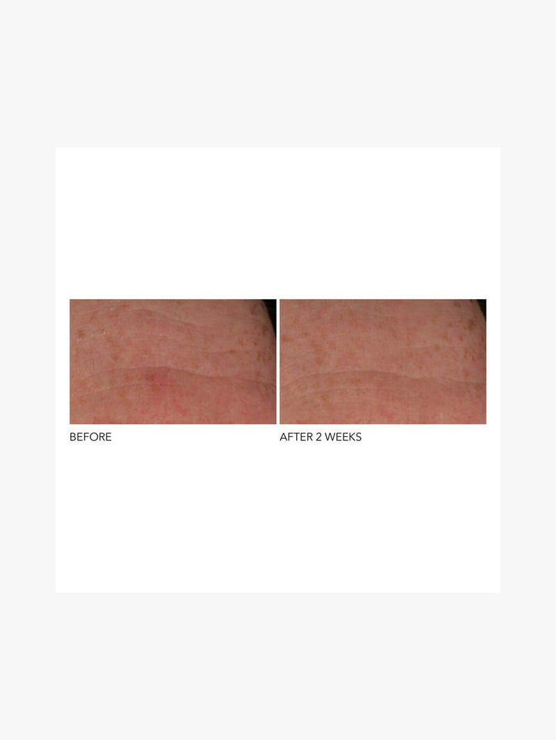 Advanced Retinol + Ferulic Overnight Wrinkle Treatment