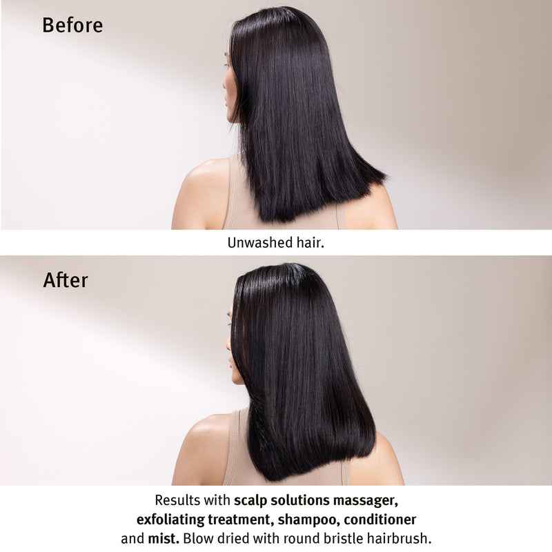 Scalp Solutions Stimulating Scalp Massager