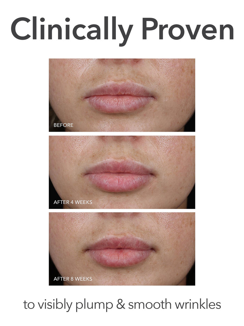DRx Spectralite™ LipWare Pro
