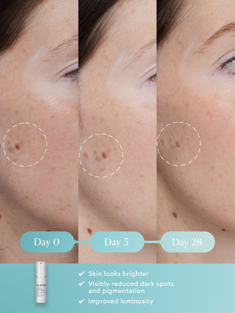 Dynamic Resurfacing Super-C Serum