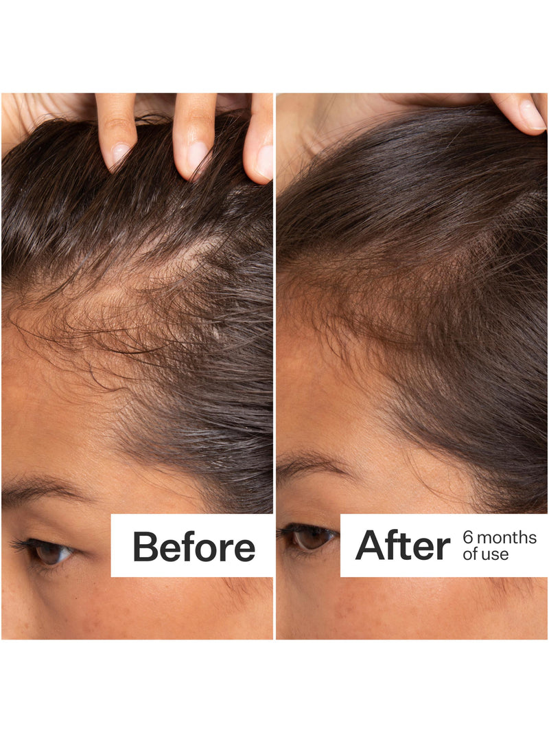 Cold Processed® Stem Cell Scalp Serum