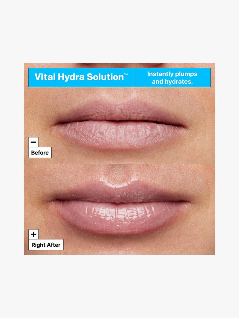 Vital Hydra Solution Hydrating Lip Mask Jelly Bear