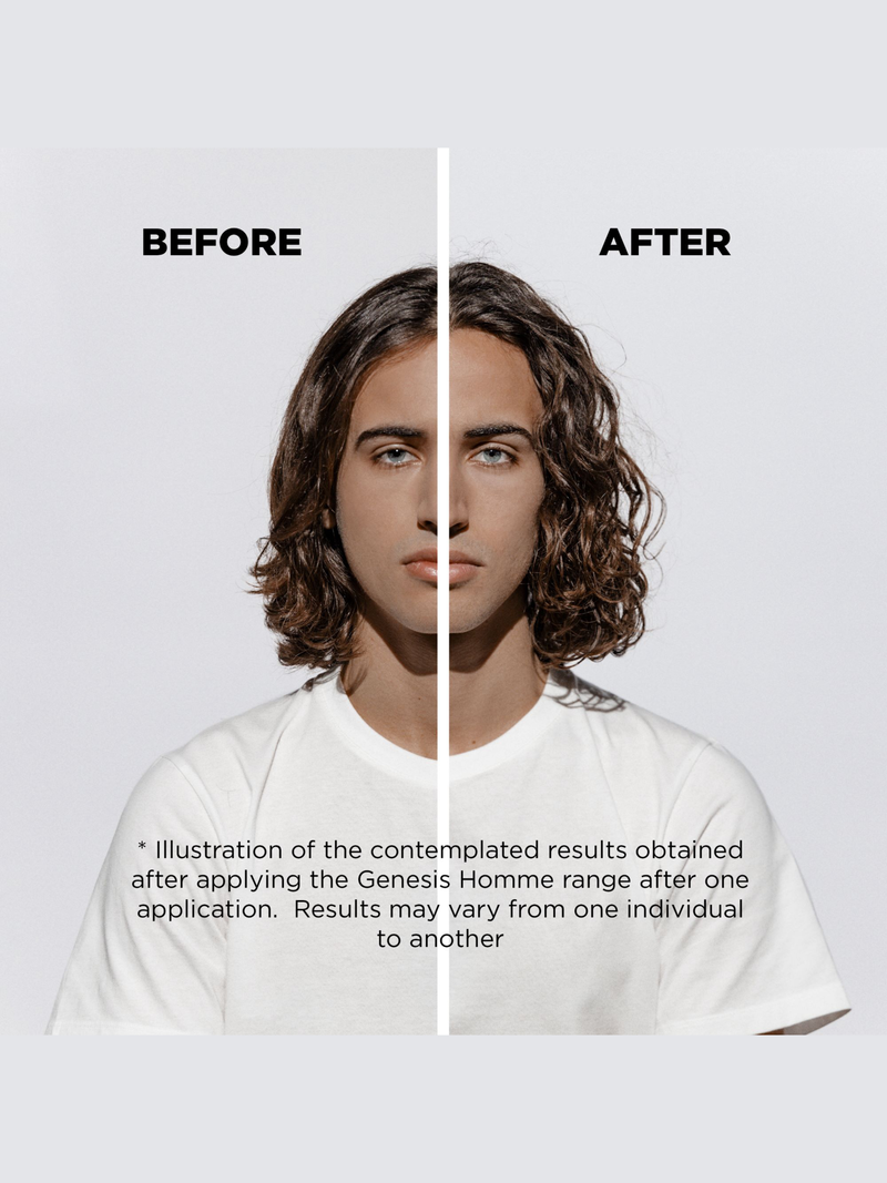 Genesis Homme Anti-Hair Fall Serum