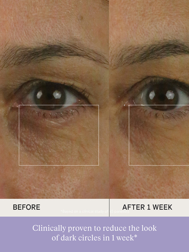 The Brightening Eye Cream