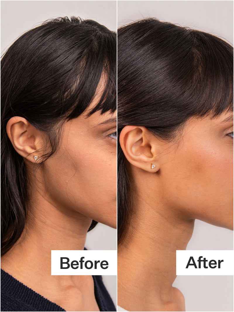 4% Niacinamide Scalp Serum