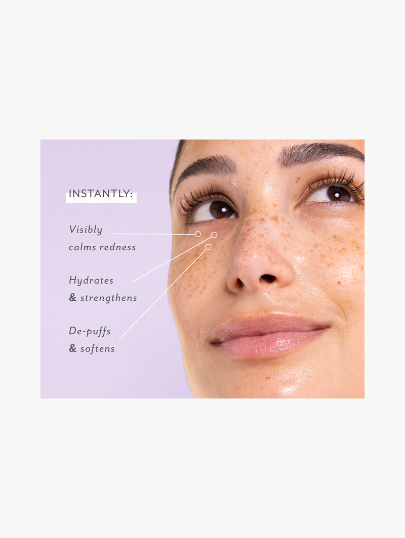 Skin Remedy Soothing Eye Gels