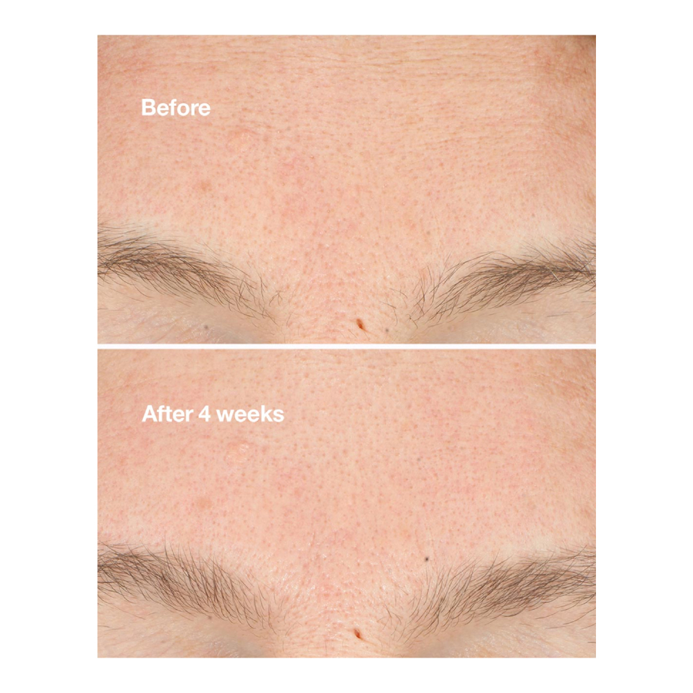 Clarifying Do-Over Peel - 30ml