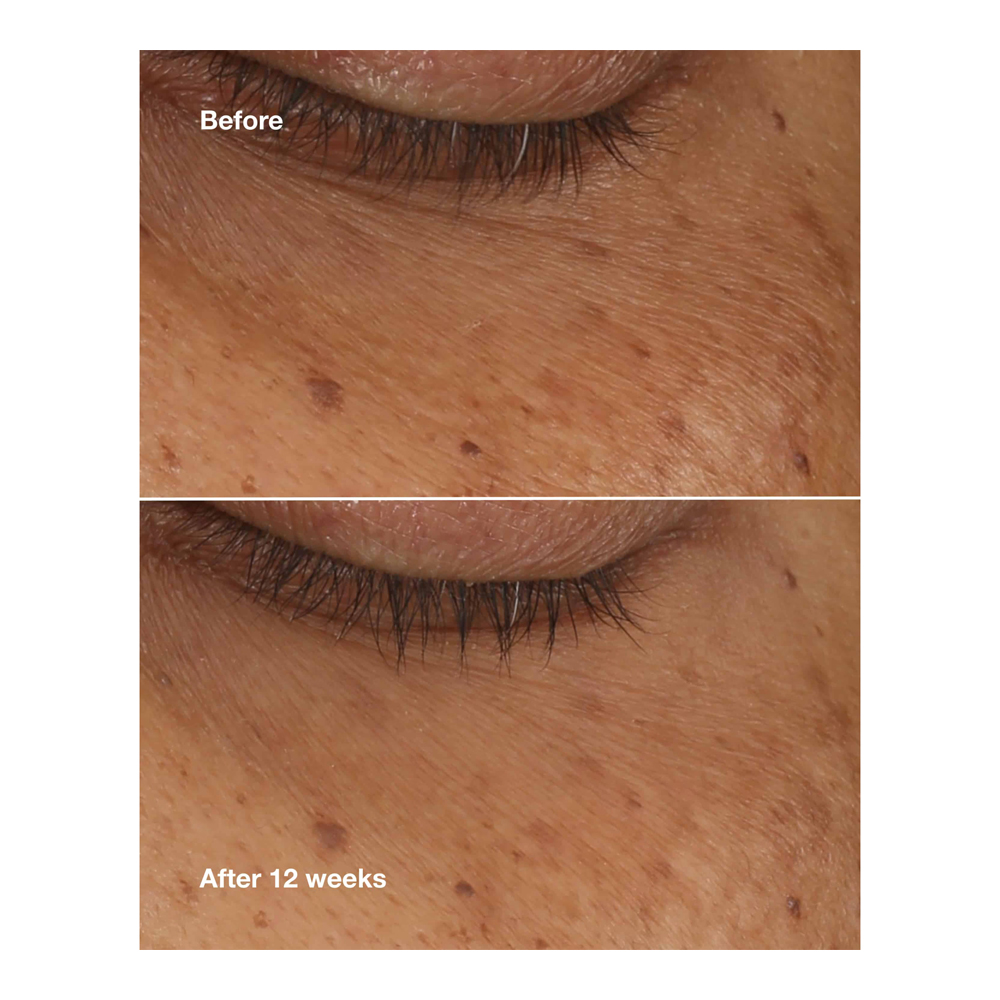 All About Eyes Brightening Serum Concentrate - 10ml