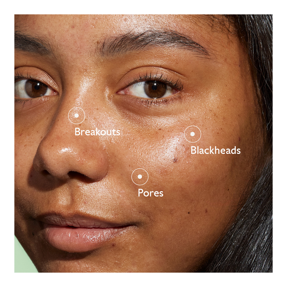 New Vinopure Blemish Control Salicylic Serum - 30ml