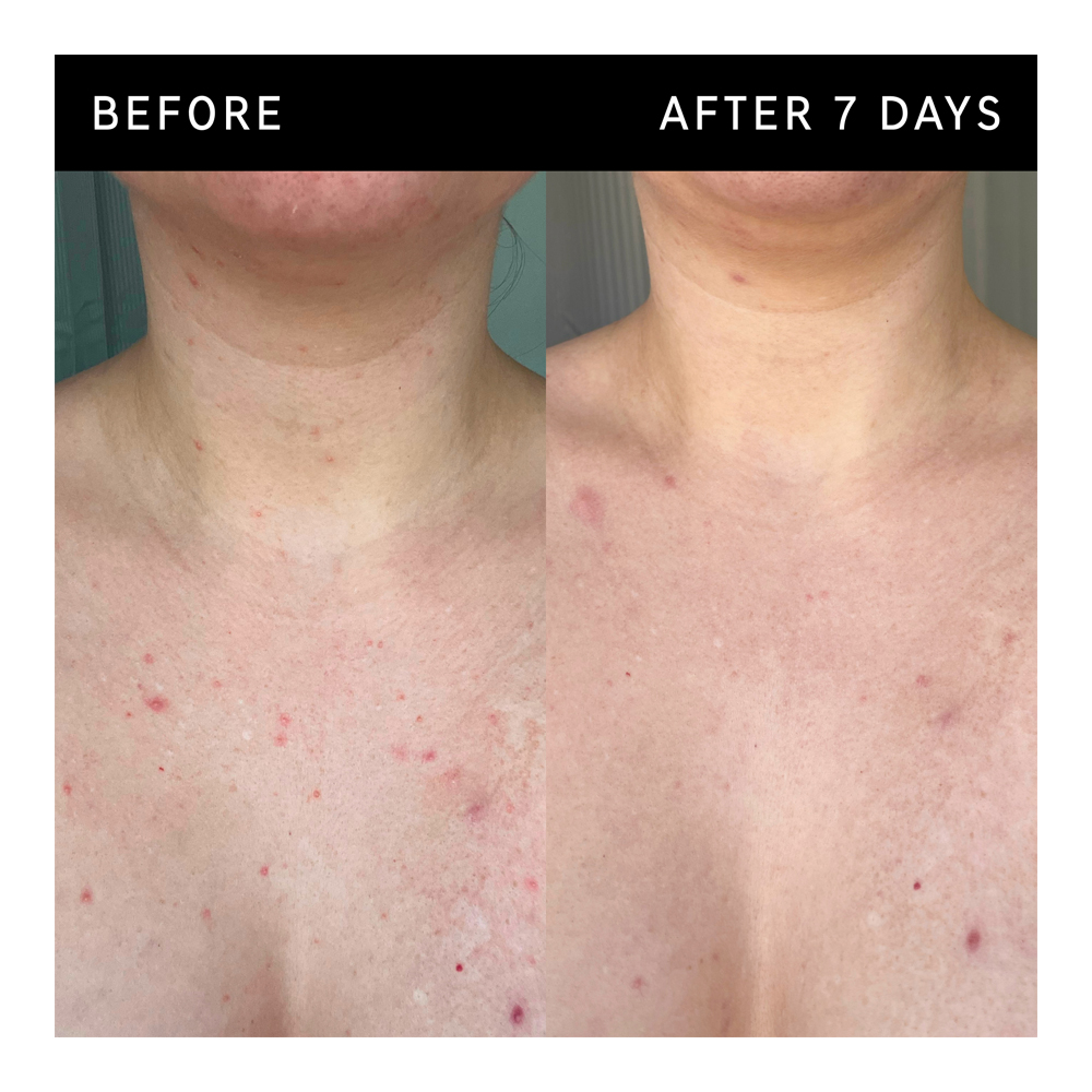 Glycolic Acid Exfoliating Body Stick - 45g