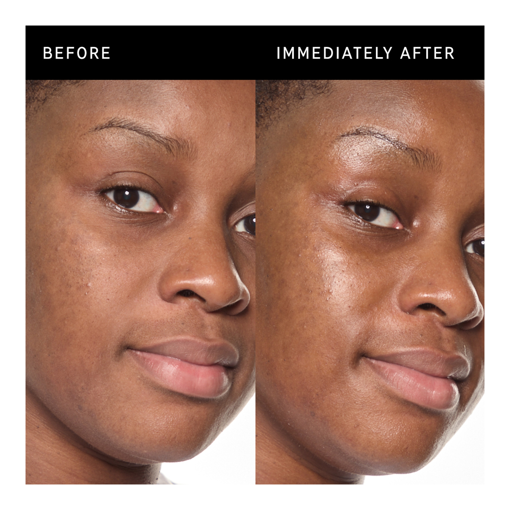 Ectoin Hydro-Barrier Serum - 30ml