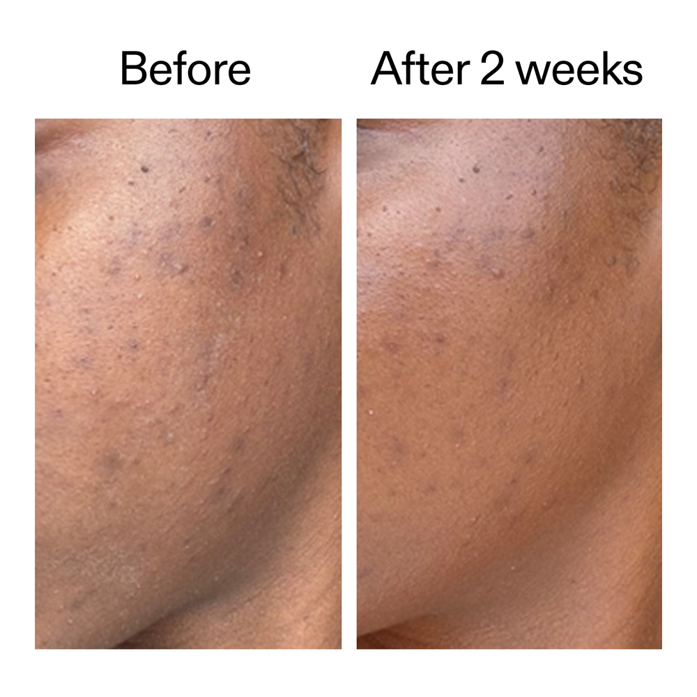 360° Skin Clearing Serum - 30ml