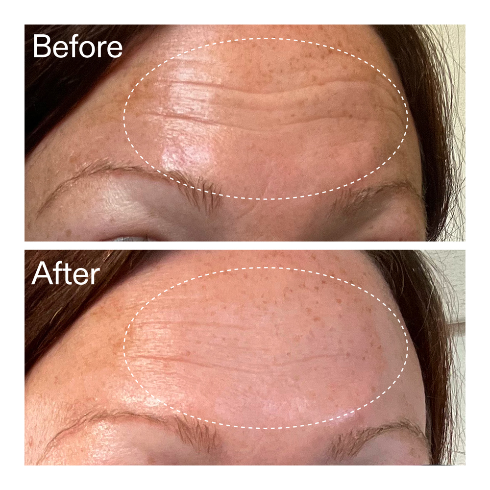 Starter Retinol Serum - 30ml
