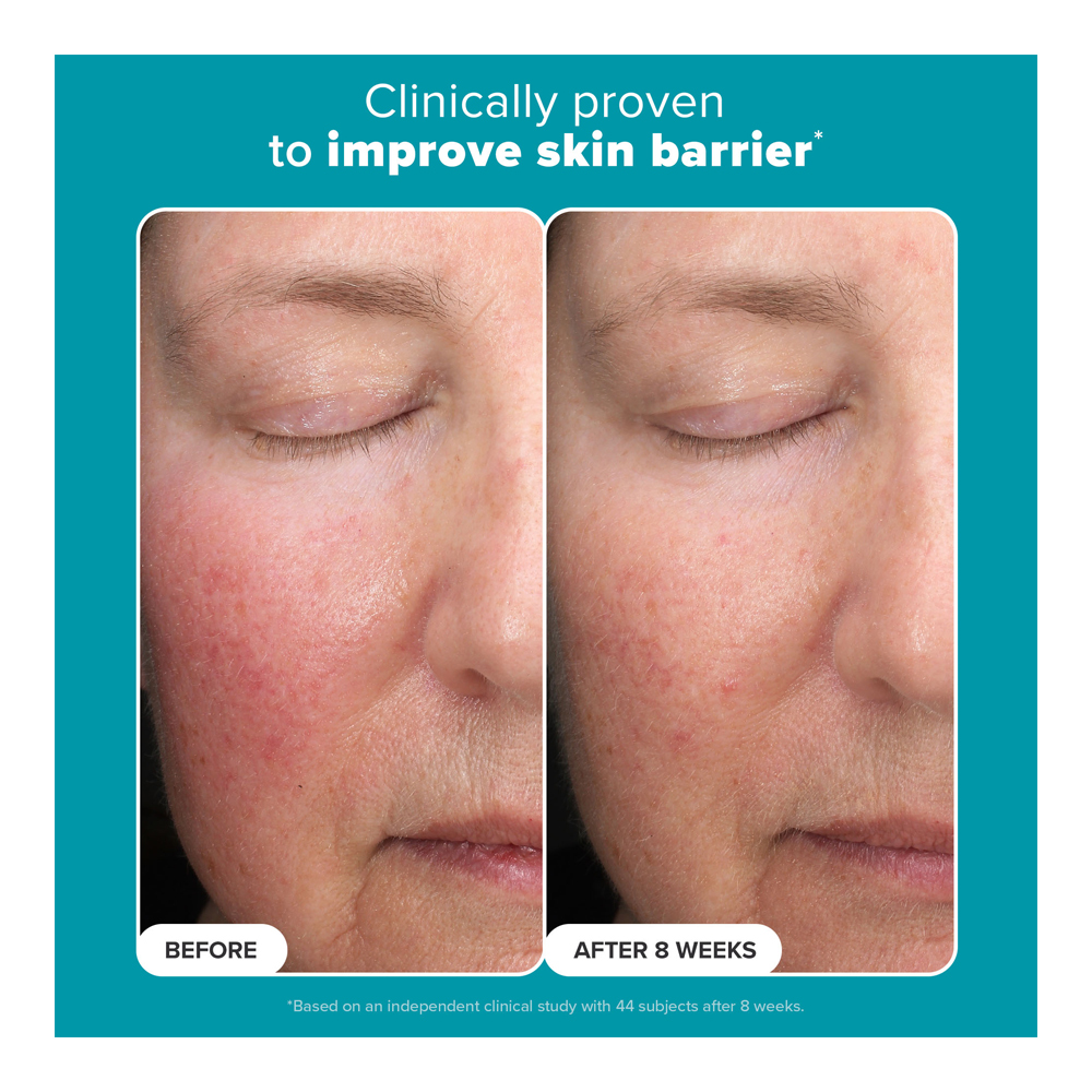Skin Perfecting 6% Mandelic + 2% Lactic Acid Liquid Exfoliant - 88ml