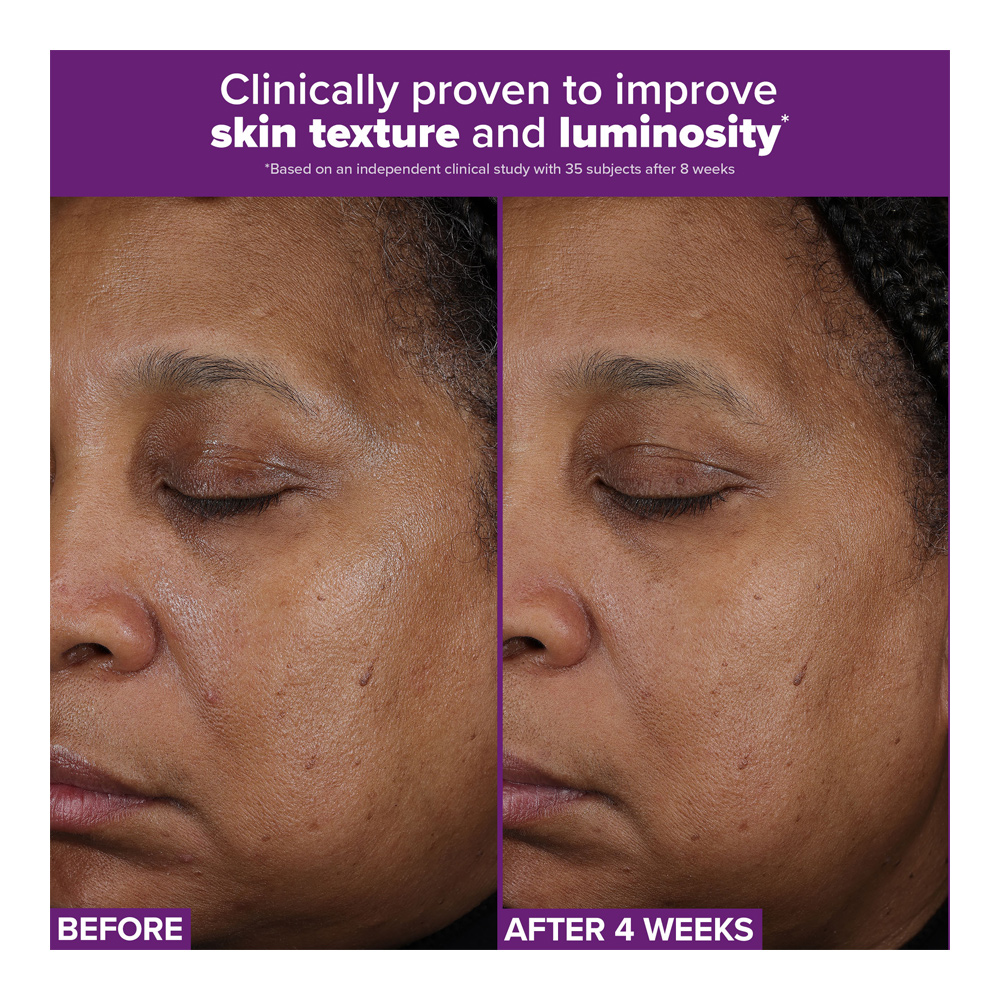 Clinical Pro Retinaldehyde Treatment - 30ml