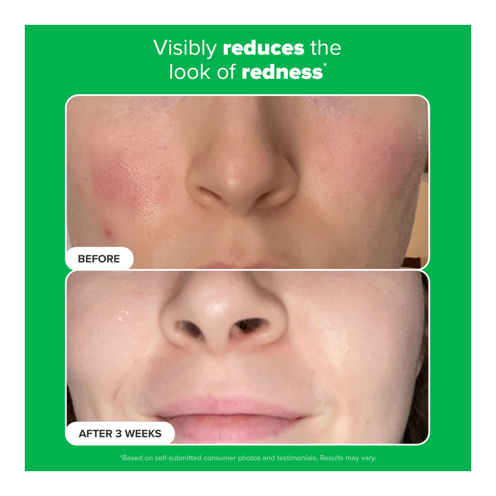 10% Azelaic Acid Booster - 30ml