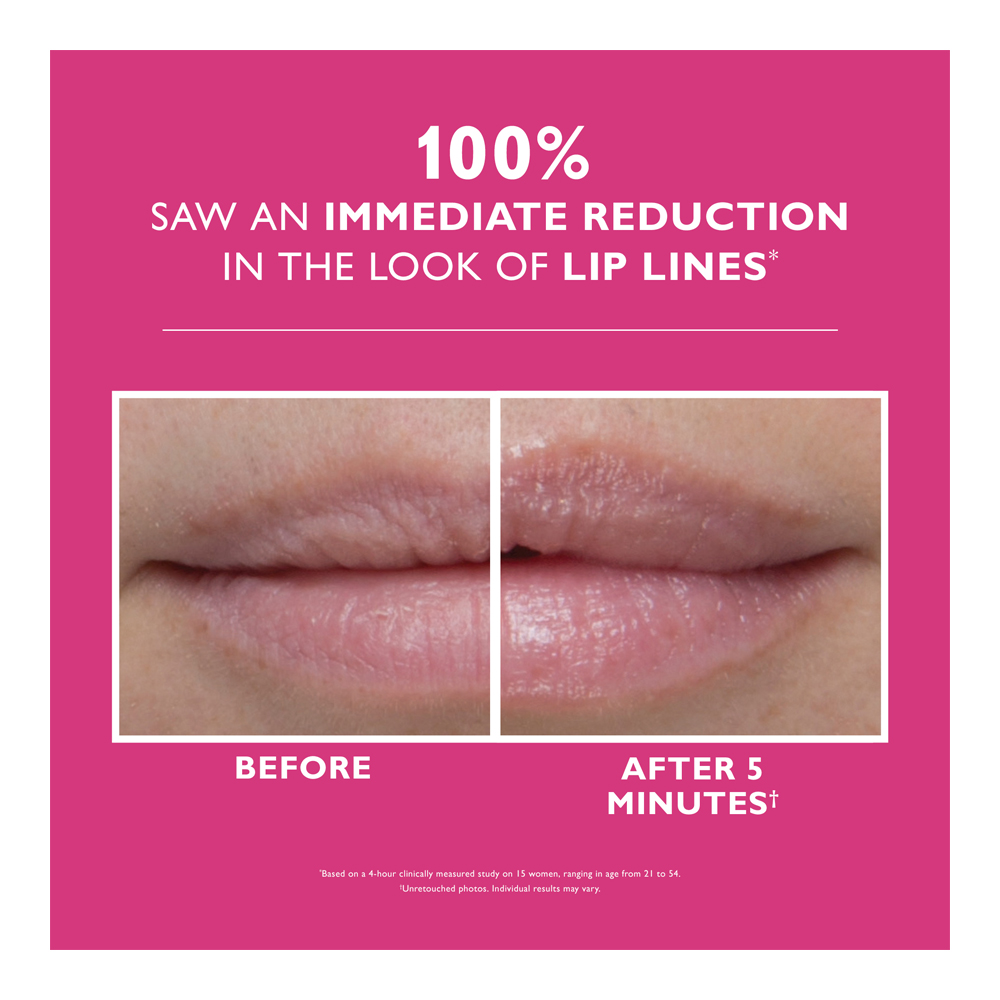 Instant Firmx® Lip Filler - 10ml