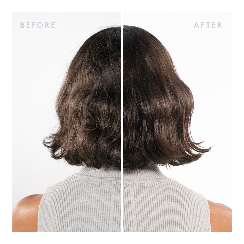 Scalp Remedy Shampoo - 240ml